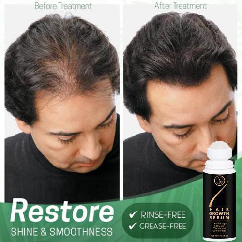 Avora's Hair Growth Roll-On