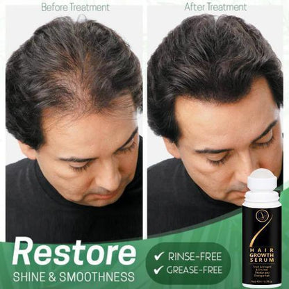 Avora's Hair Growth Roll-On