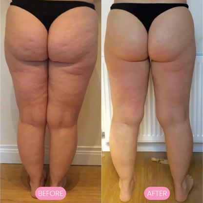 Avora™ MuscleEase Roller